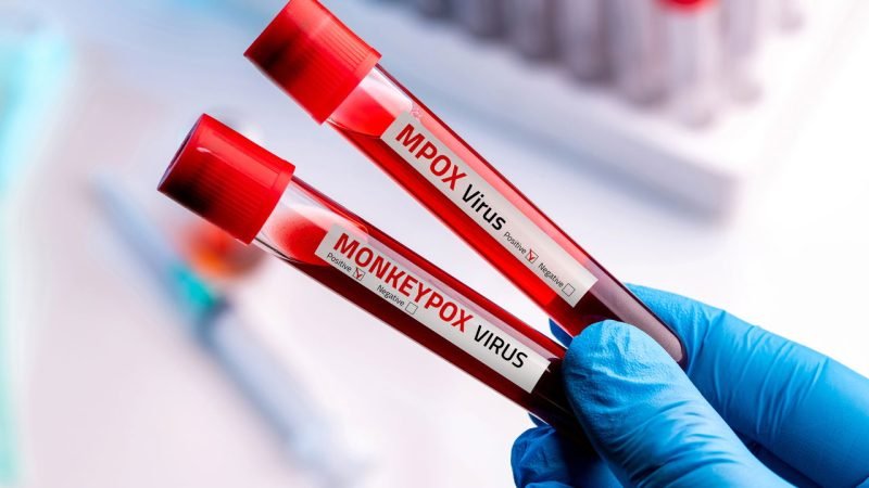 Confirmado o primeiro caso da nova cepa da Mpox no